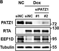 Fig.11.B showing Western Blotting in a Homo sapiens (Human) sample from the publication: Repression of EEF1D by KSHV RTA promotes viral lytic reactivation.