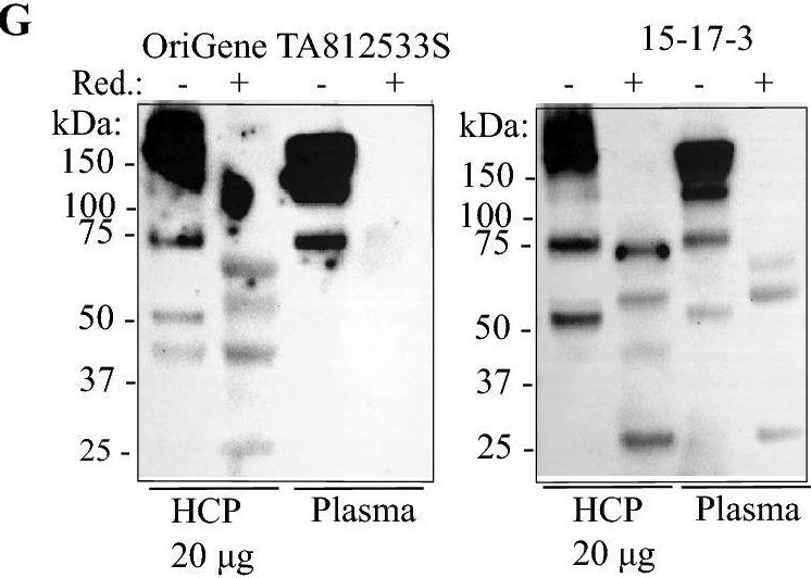 Fig.1.G showing Western Blotting from the publication: Mannan-binding lectin serine protease-2 (MASP-2) in human kidney and its relevance for proteolytic activation of the epithelial sodium channel.