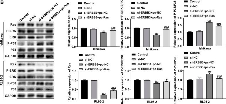 Fig.4.B showing Western Blotting in a Homo sapiens (Human) sample from the publication: ERBB3 Promotes Malignant Behaviors of Endometrial Cancer Cells with Involvement of the Ras-ERK/MAPK Signaling Pathway.