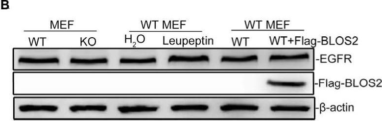 Fig.8.B showing Western Blotting from the publication: BLOS2 negatively regulates Notch signaling during neural and hematopoietic stem and progenitor cell development.