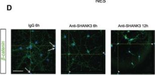 MRKページ SHANK3 (D5K6R) Rabbit Monoclonal Antibody | Cell Signaling Technology