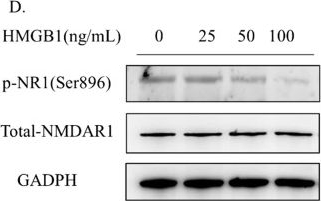 Fig.6.D showing Western Blotting from the publication: HMGB1 mediates cognitive impairment caused by the NLRP3 inflammasome in the late stage of traumatic brain injury.