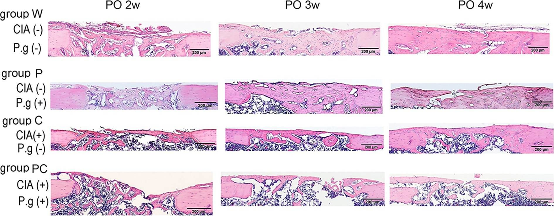 Fig.3.A showing Immunohistochemistry in a Mus musculus (House mouse) sample from the publication: Experimental arthritis and Porphyromonas gingivalis administration synergistically decrease bone regeneration in femoral cortical defects.
