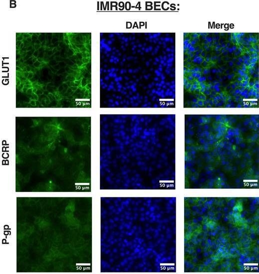 Fig.3.B showing Immunocytochemistry-immunofluorescence from the publication: Using a brain-like endothelial cell differentiation to characterize the CS79iBRCA-n2 BRCA1 mutated patient derived stem cell line.