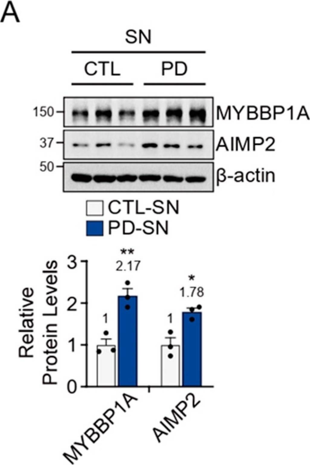 Fig.4.A showing Western Blotting from the publication: Deubiquitinase USP29 Governs MYBBP1A in the Brains of Parkinson's Disease Patients.