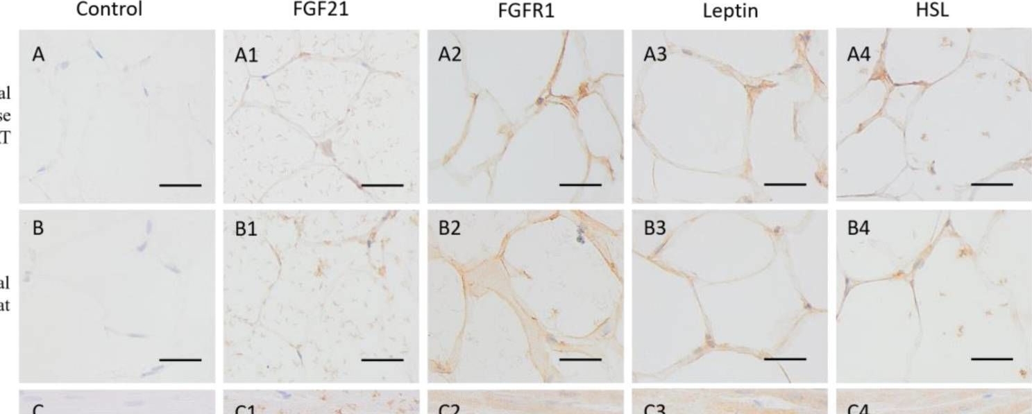 Fig.3.A showing Immunohistochemistry from the publication: Localization of FGF21 Protein and Lipid Metabolism-Related Genes in Camels.
