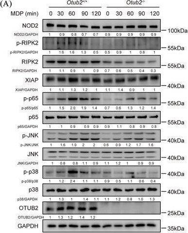 Fig.5.A showing Western Blotting from the publication: Deubiquitination of RIPK2 by OTUB2 augments NOD2 signalling and protective effects in intestinal inflammation.
