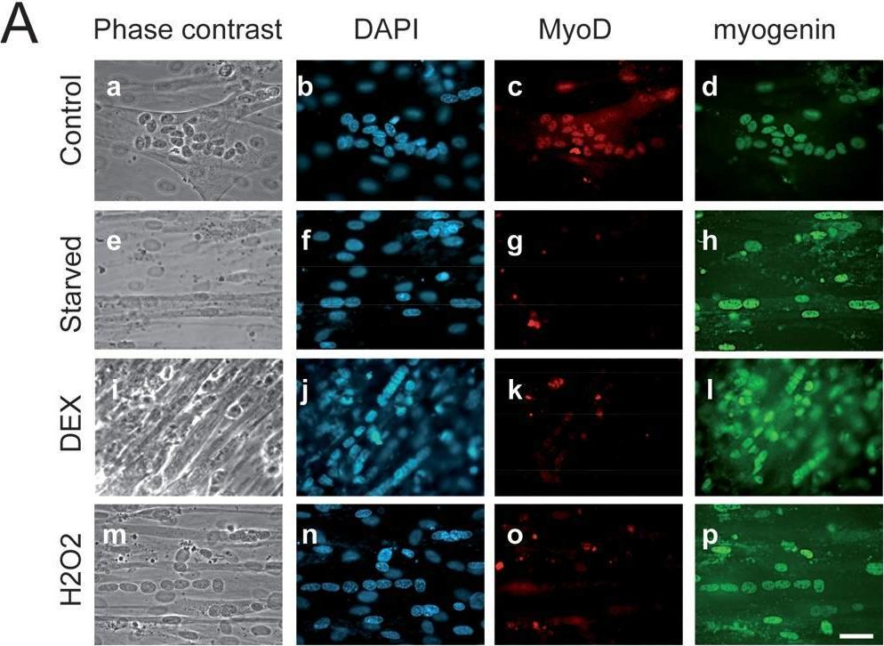 Fig.3.A showing Immunocytochemistry-immunofluorescence from the publication: Inhibition of atrogin-1/MAFbx mediated MyoD proteolysis prevents skeletal muscle atrophy in vivo.