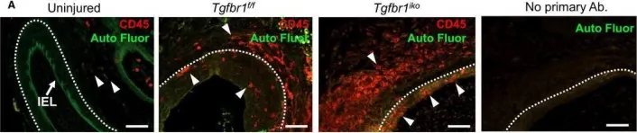 Fig.6.A showing Immunohistochemistry-immunofluorescence from the publication: Smooth muscle cell-specific Tgfbr1 deficiency attenuates neointimal hyperplasia but promotes an undesired vascular phenotype for injured arteries.