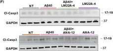 Fig.6.F showing Western Blotting from the publication: Amyloid β Instigates Cardiac Neurotrophic Signaling Impairment, Driving Alzheimer's Associated Heart Disease.
