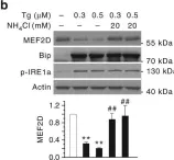 Fig.1.B showing Western Blotting in a Mus musculus (House mouse) sample from the publication: Phosphorylation of LAMP2A by p38 MAPK couples ER stress to chaperone-mediated autophagy.