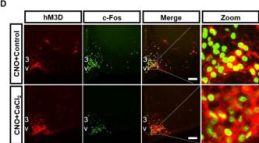 6/7①かい@プロフ◆BJ×2（svn、oct） cFos Antibody (9F6) | Cell Signaling Technology