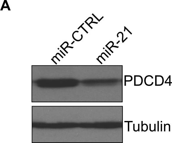 Fig.2.A showing Western Blotting in a Homo sapiens (Human) sample from the publication: ERK8 is a novel HuR kinase that regulates tumour suppressor PDCD4 through a miR-21 dependent mechanism.