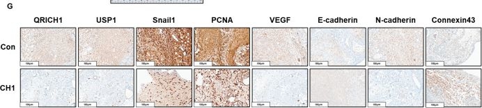 Fig.9.G showing Immunohistochemistry in a Mus musculus (House mouse) sample from the publication: Targeting QRICH1 suppresses epithelial-mesenchymal transition and tumor growth in liver cancer through the Connexin43/USP1 mediated Snail1 stabilization.