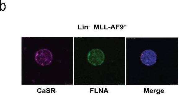 Fig.5.B showing Immunocytochemistry-immunofluorescence in a Homo sapiens (Human) sample from the publication: Distinct and targetable role of calcium-sensing receptor in leukaemia.