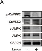 Fig.4.A showing Western Blotting in a Rattus norvegicus (Rat) sample from the publication: Setmelanotide-mediated MC4R activation improves hypothalamic obesity via CaMKK2/AMPK pathways.