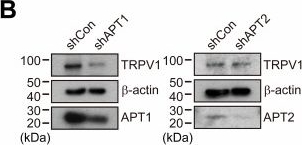 Fig.7.B showing Western Blotting from the publication: Palmitoylation by ZDHHC4 inhibits TRPV1-mediated nociception.
