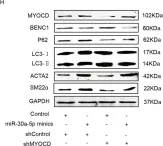 Fig.3.H showing Western Blotting in a Homo sapiens (Human) sample from the publication: Myocardin/microRNA-30a/Beclin1 signaling controls the phenotypic modulation of vascular smooth muscle cells by regulating autophagy.