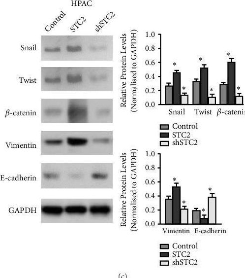 Fig.4.A showing Western Blotting from the publication: STC2 Is a Potential Prognostic Biomarker for Pancreatic Cancer and Promotes Migration and Invasion by Inducing Epithelial-Mesenchymal Transition.