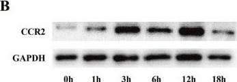 Fig.4.B showing Western Blotting in a Homo sapiens (Human) sample from the publication: Identification and validation of candidate genes dysregulated in alveolar macrophages of acute respiratory distress syndrome.