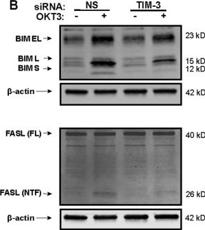 Fig.2.B showing Western Blotting from the publication: TIM-3 drives temporal differences in restimulation-induced cell death sensitivity in effector CD8+ T cells in conjunction with CEACAM1.
