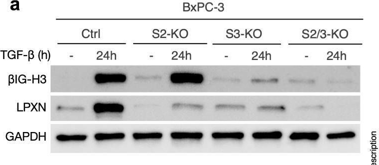 Fig.3.A showing Western Blotting in a Homo sapiens (Human) sample from the publication: SMAD2/3 mediate oncogenic effects of TGF-β in the absence of SMAD4.