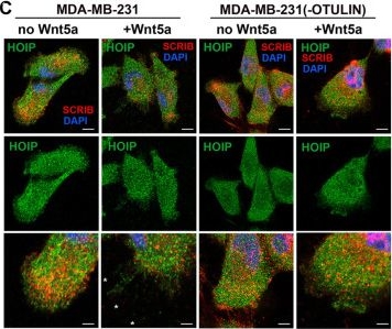Fig.6.C showing Immunocytochemistry-immunofluorescence in a Homo sapiens (Human) sample from the publication: An interaction between OTULIN and SCRIB uncovers roles for linear ubiquitination in planar cell polarity.