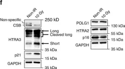 Fig.7.F showing Western Blotting from the publication: CSB promoter downregulation via histone H3 hypoacetylation is an early determinant of replicative senescence.