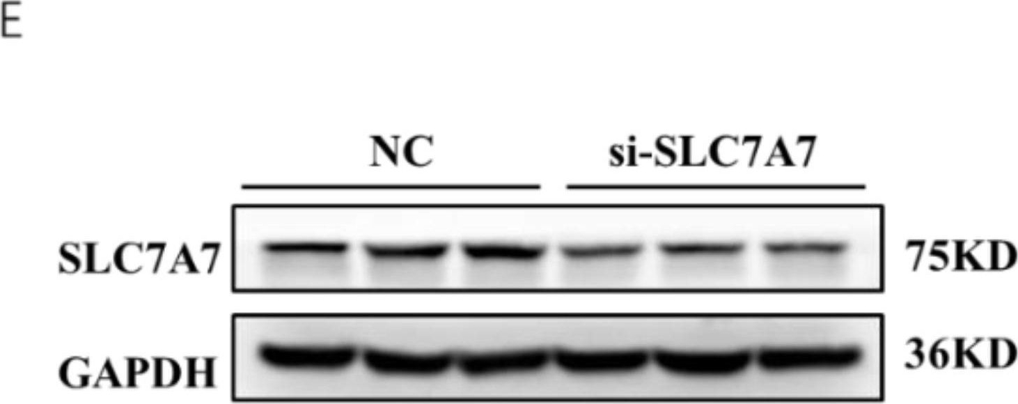 Fig.4.E showing Western Blotting from the publication: Glucocorticoid Regulates the Synthesis of Porcine Muscle Protein through m6A Modified Amino Acid Transporter SLC7A7.