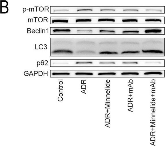 Fig.5.B showing Western Blotting in a Mus musculus (House mouse) sample from the publication: Minnelide combined with anti-ANGPTL3-FLD monoclonal antibody completely protects mice with adriamycin nephropathy by promoting autophagy and inhibiting apoptosis.