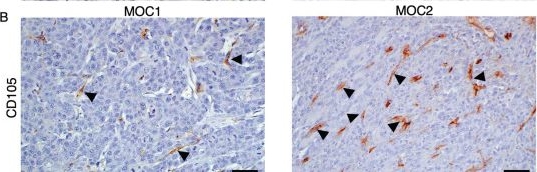Fig.3.B showing Immunohistochemistry from the publication: CXCR4 Inhibition Induces Tumor Necrosis by Selectively Targeting the Proliferating Blood Vessels in Oral Squamous Cell Carcinoma.