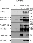Fig.2.A showing Western Blotting in a Homo sapiens (Human) sample from the publication: IGF-1R nuclear import and recruitment to chromatin involves both alpha and beta subunits.