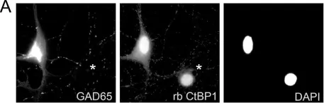 Fig.5.A showing Immunocytochemistry-immunofluorescence from the publication: Differential spatial expression and subcellular localization of CtBP family members in rodent brain.