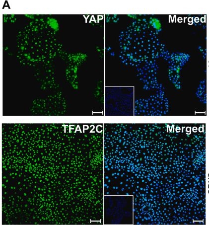 Fig.3.A showing Immunocytochemistry-immunofluorescence from the publication: Derivation of human trophoblast stem cells from placentas at birth.