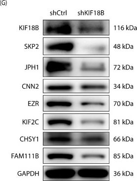 Fig.3.G showing Western Blotting in a Homo sapiens (Human) sample from the publication: KIF18B Modulates SKP2 Ubiquitination to Promote Aerobic Glycolysis and Osteosarcoma Progression.
