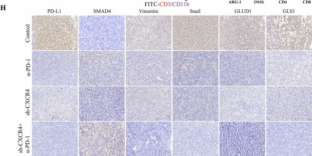 Fig.8.H showing Immunohistochemistry from the publication: Multi-omics reveals CXCR4 drives immune escape in colorectal cancer via metabolic reprogramming and immune microenvironment remodeling.