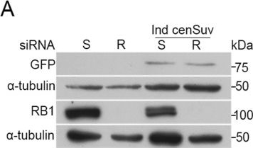 Fig.4.A showing Western Blotting in a Homo sapiens (Human) sample from the publication: RB dependent transcriptional regulation at mitotic centromeres preserves genome stability.