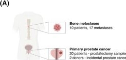 Fig.2.A from the publication: Cytomegalovirus infection is common in prostate cancer and antiviral therapies inhibit progression in disease models.
