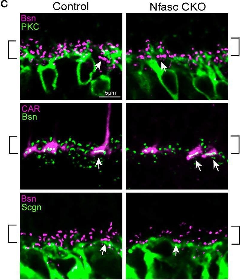 Fig.3.C showing Immunohistochemistry-immunofluorescence in a Mus musculus (House mouse) sample from the publication: Neurofascin Is a Novel Component of Rod Photoreceptor Synapses in the Outer Retina.