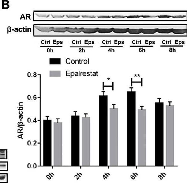 Fig.4.B showing Western Blotting in a Mus musculus (House mouse) sample from the publication: The Aldose Reductase Inhibitor Epalrestat Maintains Blood-Brain Barrier Integrity by Enhancing Endothelial Cell Function during Cerebral Ischemia.