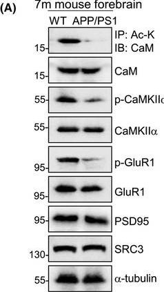 Fig.2.A showing Western Blotting in a Mus musculus (House mouse) sample from the publication: HDAC9-mediated calmodulin deacetylation induces memory impairment in Alzheimer's disease.
