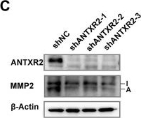 Fig.5.C showing Western Blotting in a Mus musculus (House mouse) sample from the publication: Endothelial anthrax toxin receptor 2 plays a protective role in liver fibrosis.