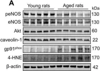 Fig.2.A showing Western Blotting from the publication: Age-Dependent Decrease in Adropin is Associated with Reduced Levels of Endothelial Nitric Oxide Synthase and Increased Oxidative Stress in the Rat Brain.