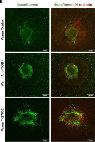 Fig.6.B showing Immunocytochemistry-immunofluorescence in a Homo sapiens (Human) sample from the publication: Development of Tissue-Engineered Model of Fibrotic Scarring after Spinal Cord Injury to Study Astrocyte Activation and Neurite Outgrowth In Vitro.