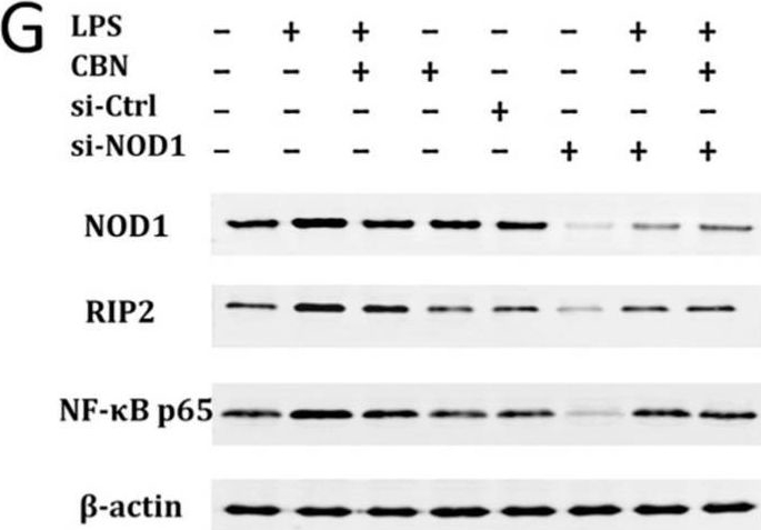 Fig.3.G showing Western Blotting in a Homo sapiens (Human) sample from the publication: Columbianadin Suppresses Lipopolysaccharide (LPS)-Induced Inflammation and Apoptosis through the NOD1 Pathway.