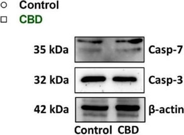 Fig.4.O showing Western Blotting from the publication: Exploring the Therapeutic Potential of Cannabidiol in U87MG Cells: Effects on Autophagy and NRF2 Pathway.