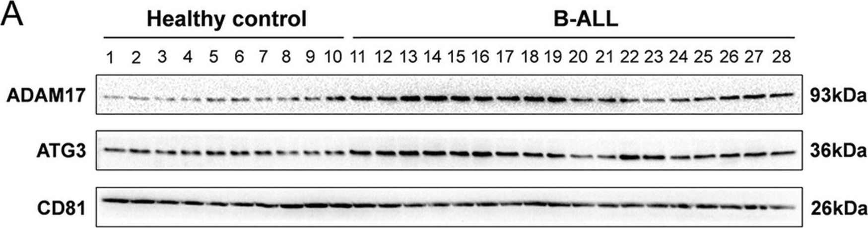 Fig.6.A showing Western Blotting in a Homo sapiens (Human) sample from the publication: Proteomic profiling of plasma exosomes from patients with B-cell acute lymphoblastic leukemia.