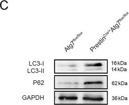 Disruption of Atg7-dependent autophagy causes electromotility disturbances, outer hair cell loss, and deafness in mice.