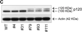 Fig.8.C showing Western Blotting in a Homo sapiens (Human) sample from the publication: Implications of targeted genomic disruption of β-catenin in BxPC-3 pancreatic adenocarcinoma cells.