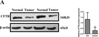 Fig.2.A showing Western Blotting in a Homo sapiens (Human) sample from the publication: CFTR-driven immune microenvironment reprogramming synergizes with anti-PD-L1 antibody in hepatocellular carcinoma.